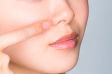 Chirurgie esthétique et réparatrice du nez. Rhinoplastie à Montpellier